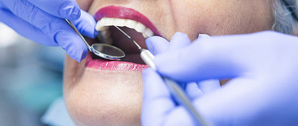 Best Emergency Dental Care for Sports Injuries in San Bruno, CA